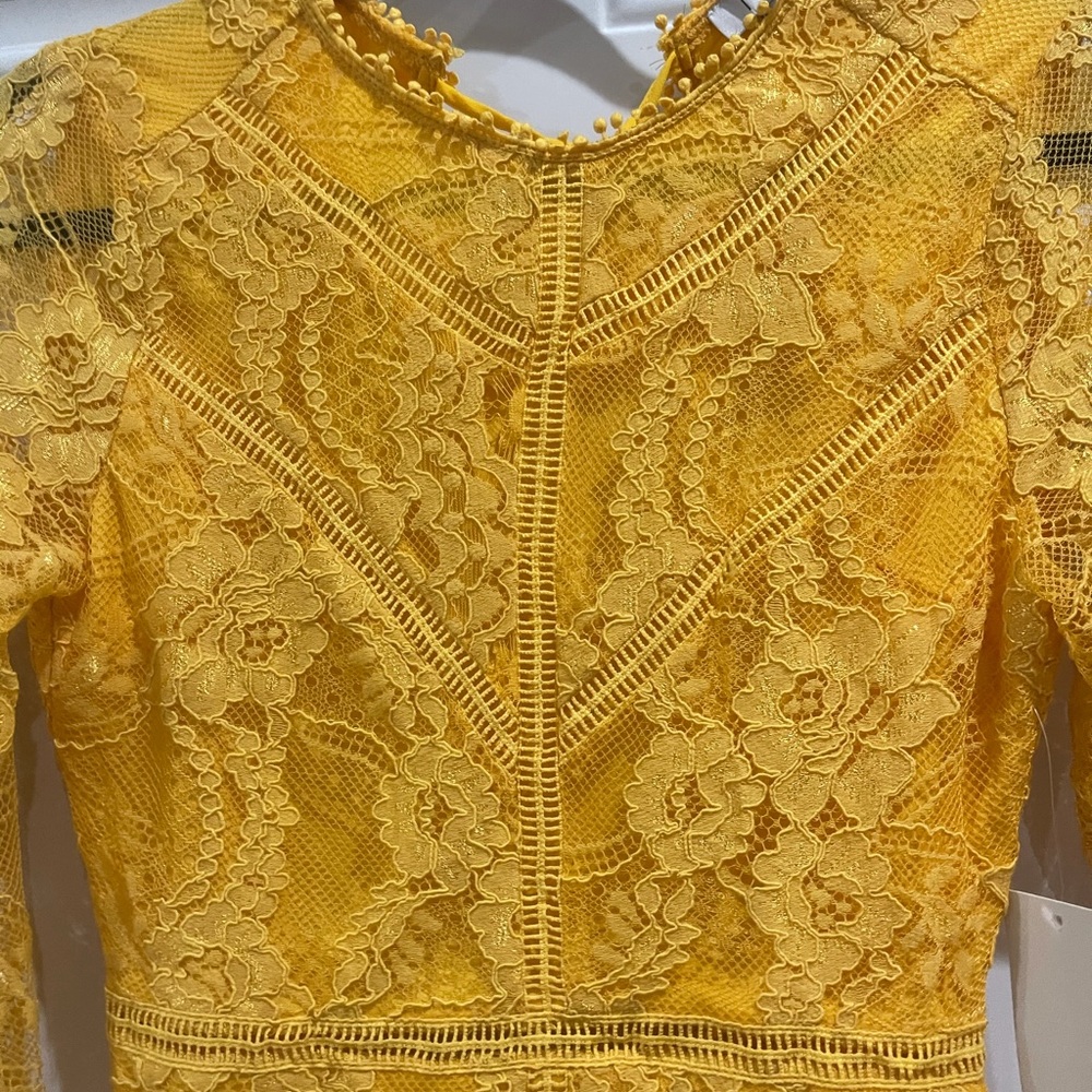 NWT Tobi yellow lace dress with open back